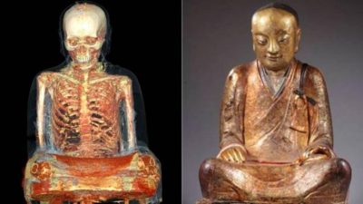 Estatuas que tienen huesos y otros descubrimientos de la radiografía