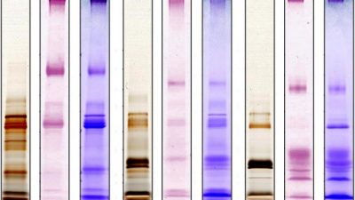 La saliva secreta de los humanos