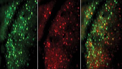 El aprendizaje provoca cambios profundos en el cerebro