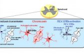 Nueva diana para el alivio del dolor crónico confirmada por los científicos