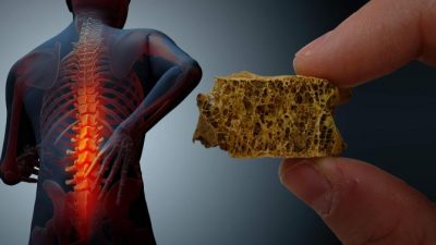 La oxitocina puede prevenir el surgimiento de la osteoporosis