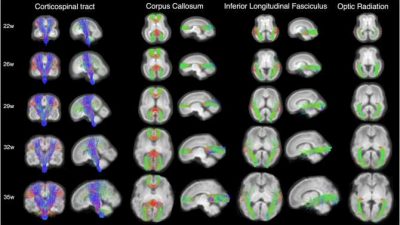 Nuevas técnicas para estudiar la maduración del cerebro fetal