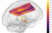 El cerebro se recalienta: Más de 40 grados en su interior