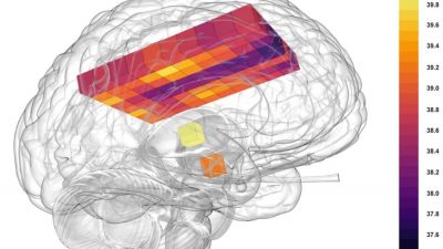 El cerebro se recalienta: Más de 40 grados en su interior