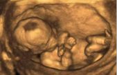 El diagnóstico prenatal, una cuestión de huevos… reptilianos