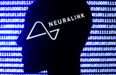 Neuralink anuncia que ya tiene autorización para probar sus implantes cerebrales en humanos