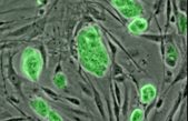 Gran avance en la medicina regenerativa: células madre para reparar tejidos dañados