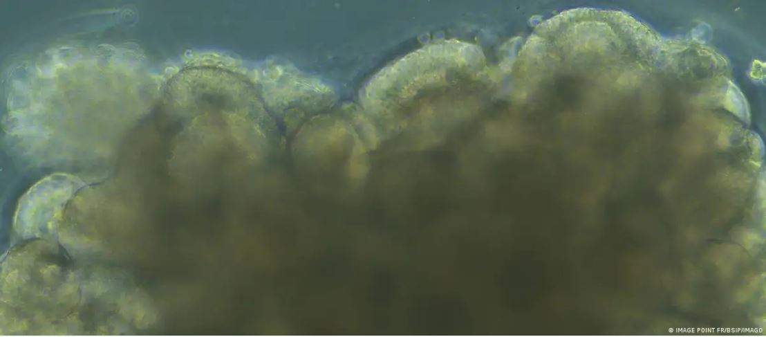 Construyen un ordenador funcional con tejido cerebral humano