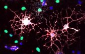 Las células reguladoras del sistema inmune aumentan con la edad, pero reducen su contribución a la regeneración de mielina