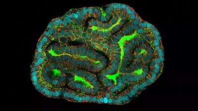 Crean organoides a partir de líquido amniótico