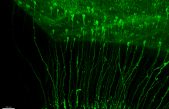 Científicos del Instituto de Neurociencias descubren la implicación de linajes paralelos de células madre en la creación de neuronas